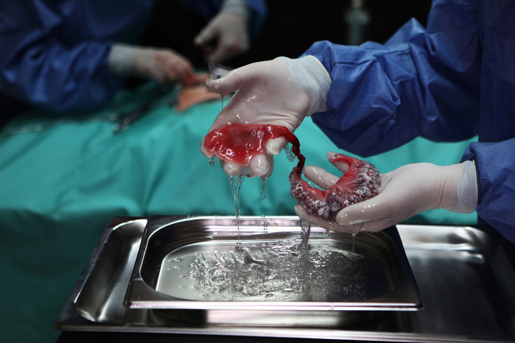 Surgical Movie by Agi Haines, employing bio-printing to duplicate and improve human organs